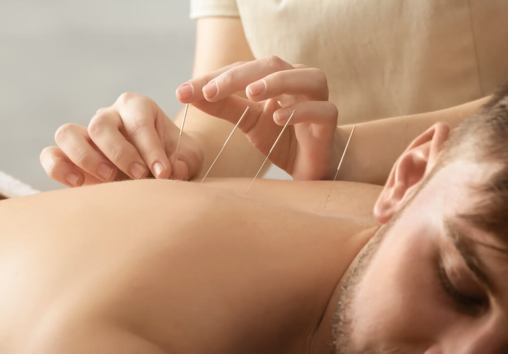 Acupuncture in Addiction Treatment: 7 Ways it Can Help